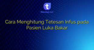 Cara Menghitung Tetesan Infus pada Pasien Luka Bakar